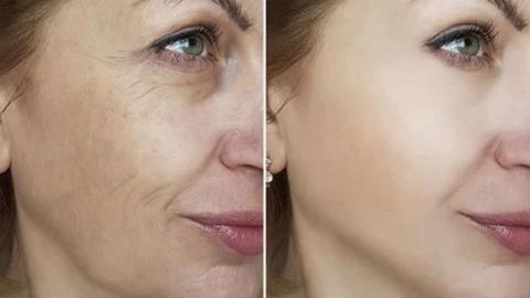 Retinol Moisturizer Face Cream